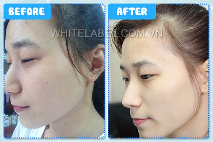 Hiệu quả dưỡng da bất ngờ từ White Label