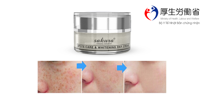Kem trị nám cao cấp ban ngày Sakura bảo vệ làn da khỏi tác hại của tia UV Kem trị nám cao cấp ban ngày Sakura bảo vệ làn da khỏi tác hại của tia UV