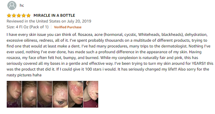 Phản hồi của khách hàng khi mua Paula’s Choice Clear Regular Strength Anti-Redness Exfoliating Solution tại Mỹ