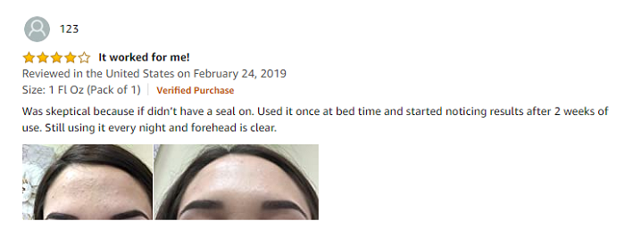 Phản hồi của khách hàng khi mua Paula’s Choice Clear Regular Strength Anti-Redness Exfoliating Solution tại Mỹ 2